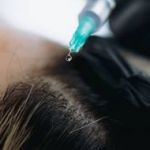 Exosomes Therapy for Hair Loss in Riyadh